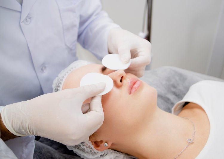 laser-treatment-for-dark-spots-on-face-best-tip